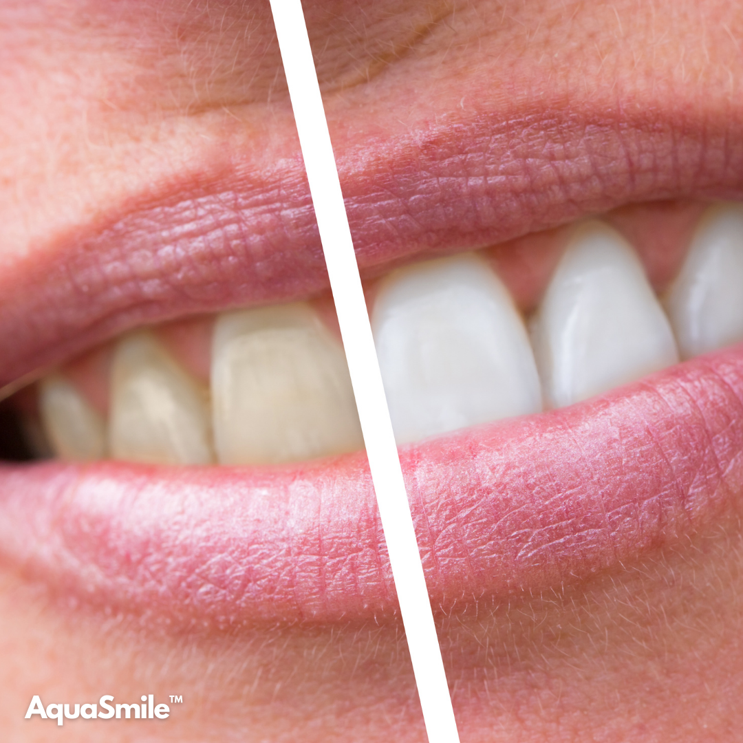 AquaSmile™ – Für ein strahlendes Lächeln, jeden Tag.