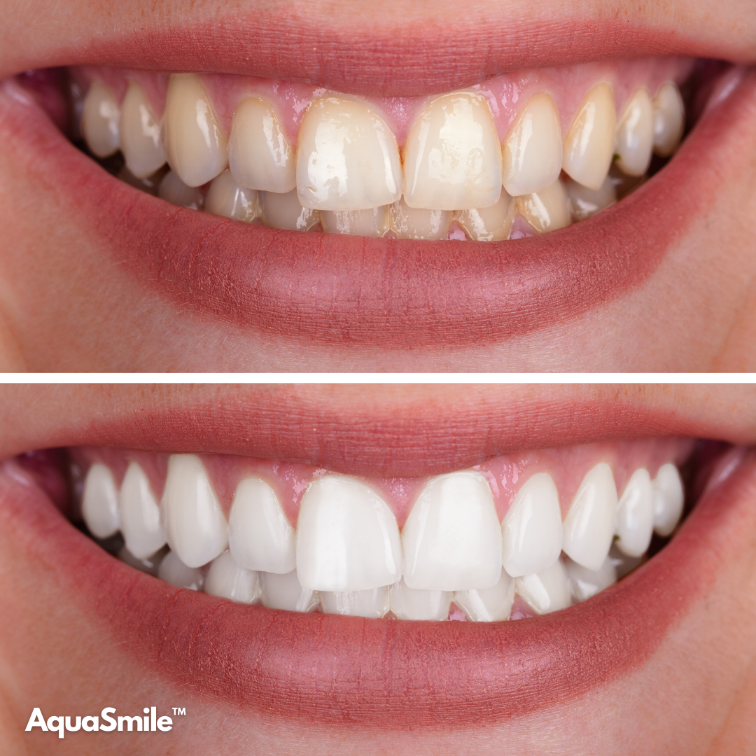 AquaSmile™ – Für ein strahlendes Lächeln, jeden Tag.
