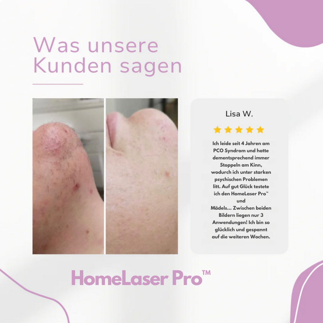 HomeLaser Pro™ – Schmerzfreie Haarentfernung für zuhause.