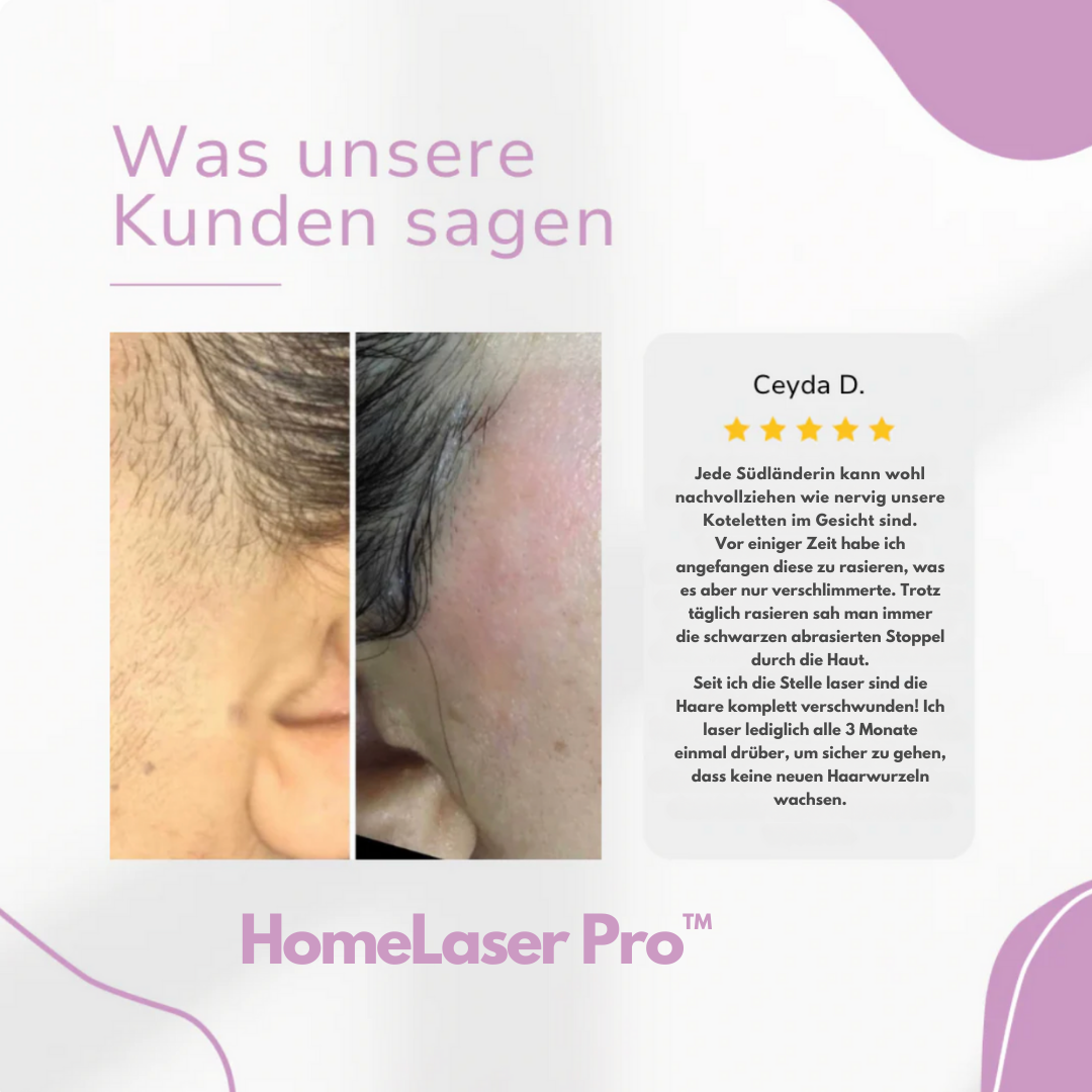 HomeLaser Pro™ – Schmerzfreie Haarentfernung für zuhause.