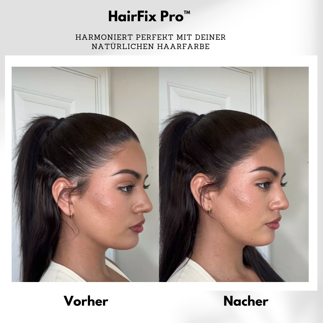 HairFix Pro™ – Für selbstbewusstes Auftreten ohne kahle Stellen